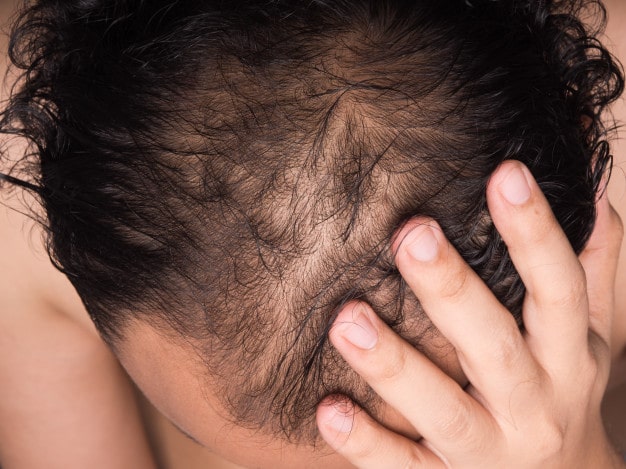 What is PhiScalp Micropigmentation