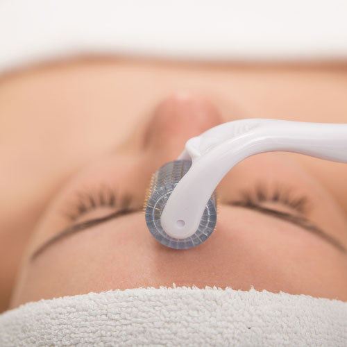 Microneedling