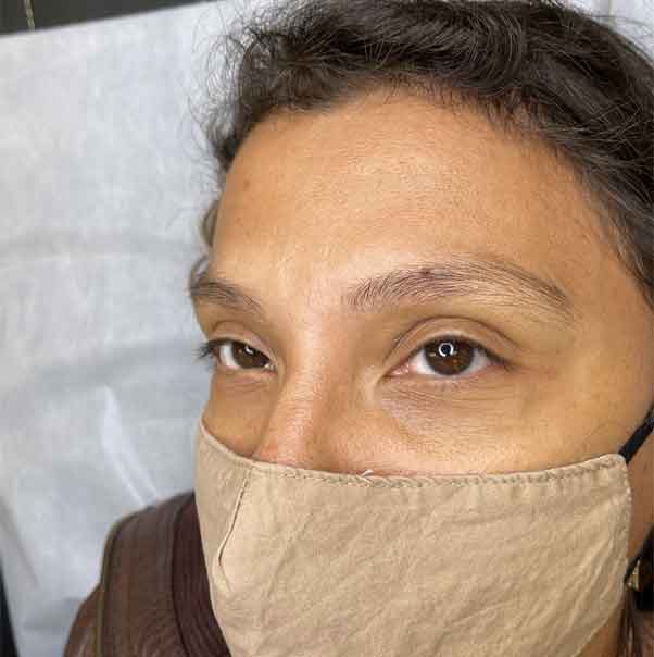 before 1 - Phibrows - Eyebrows Microblading