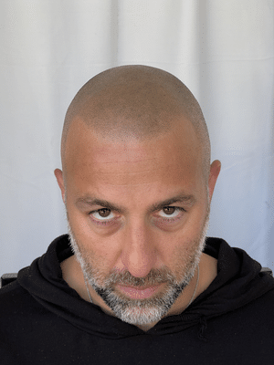 Scalp Micropigmentation - Elix Beauty - Eyebrow Microblading & Scalp Micropigmentation, Services and Training by Phi Academy Master a 1 - Scalp Micropigmentation
