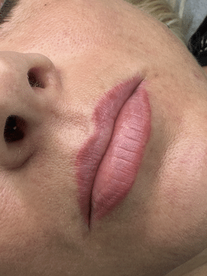 b 1 1 - Lip Tattoo - Natural Lip Liner Tattoo & Permanent Lip Color