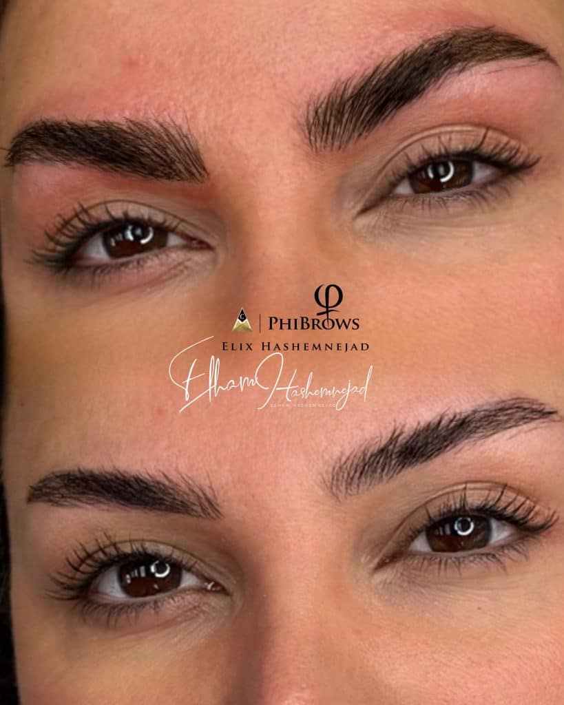 IMG 6770 - Find Your Perfect Brows at Elix Beauty: The Best Microblading in Newmarket